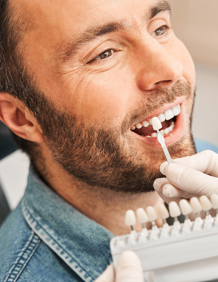 faccette dentali roma